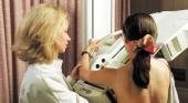 Reafirman la importancia de las mamografías a los 40 años