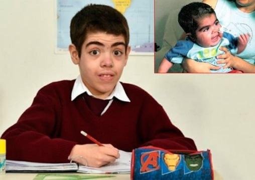 Muere a los 12 años Dal Molin, el primer bebé trasplantado de corazón en Argentina