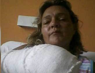 Atacaron una sargento de la Federal en Gutiérrez y le amputaron tres dedos