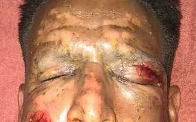Viatri evoluciona y mostró una foto de su rostro