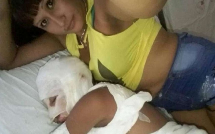 Se sacaba selfies con su hijo quemado y le quitaron la tenencia