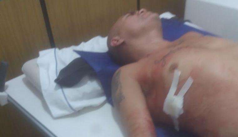Hieren con un arma blanca a la “Hiena” Barrios en un festejo por Año Nuevo