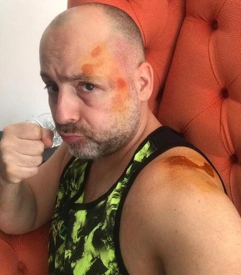 Muscari fue “despedido” de un monopatín y terminó en la guardia