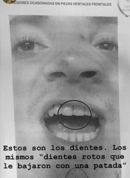 Filtran fotos del joven atacado por rugbiers: deciden si siguen presos y si ambos lo golpearon