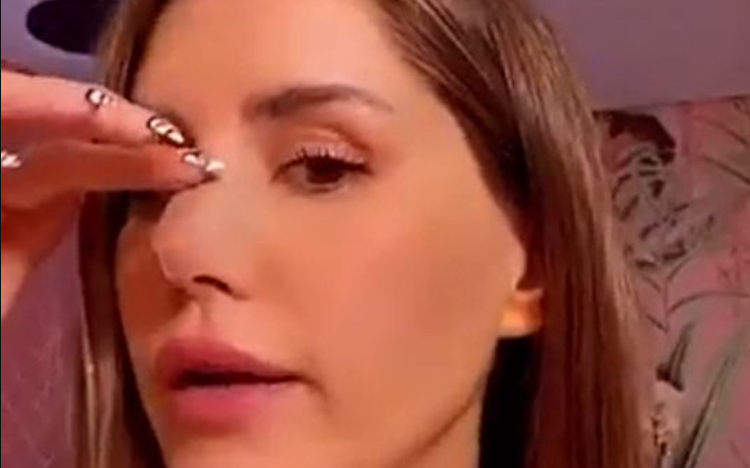Micaela Tinelli se hizo una cirugía de nariz y sufrió una complicación: "Tengo una pequeña inflamación"