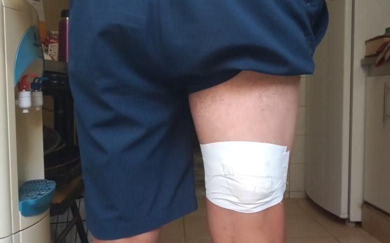 Ciclista apuñalado por ladrones en el Parque Pereyra 