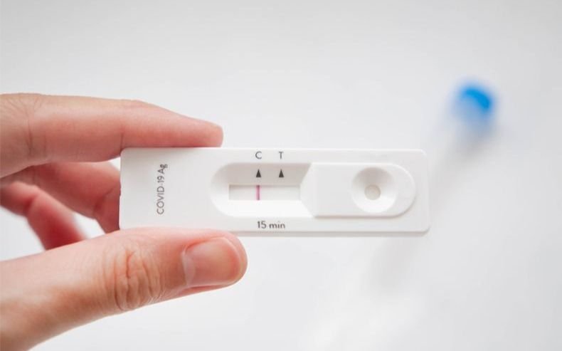 Autotest de coronavirus: le ponen fecha a la venta en farmacias tras la aprobación de Anmat