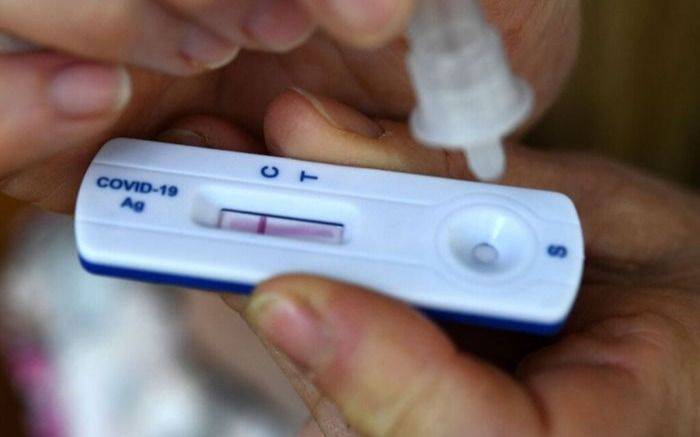 La Anmat aprobó un quinto autotest de COVID-19: mirá cuáles son los autorizados