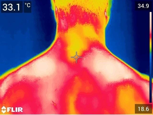 Fisioterapia con diagnóstico por calor