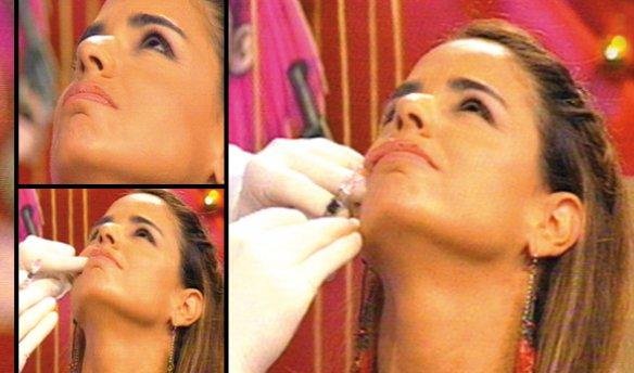 “Desfigurada”: el día que Marina Calabró se retocó la cara en la tevé