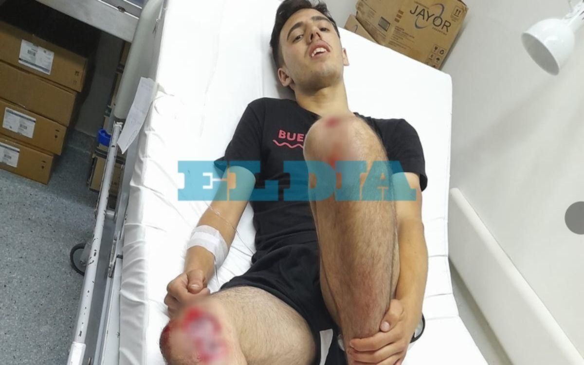 Lo atropellaron en La Plata, huyeron y sufrió graves heridas: buscan al conductor