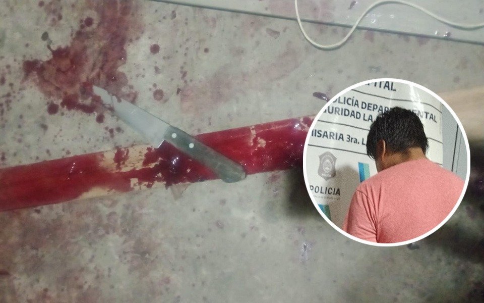 Detuvieron a un hombre acusado de atacar gravemente al hijo de su pareja en La Plata