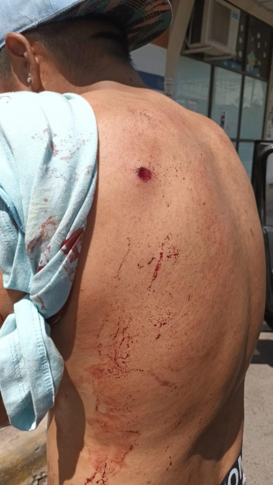 A sangre y fuego, una disputa por terrenos tomados dejó 4 muertos