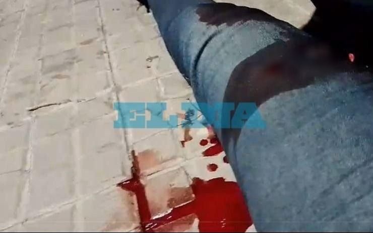 Violento ataque a un repartidor en La Plata: le quisieron robar la moto, le dieron tres tiros en las piernas y quedó internado