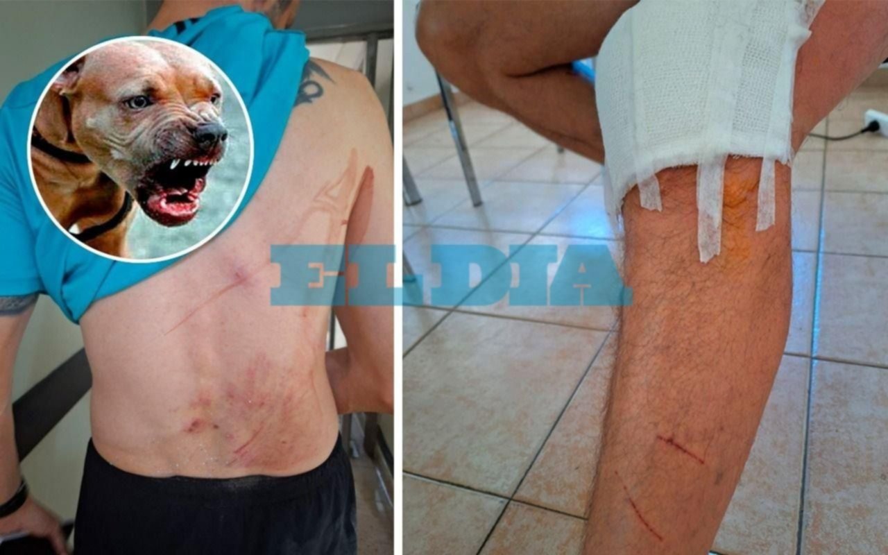 El dramático relato del hombre atacado por un pitbull en La Plata: mordeduras en el cuerpo y susto tremendo