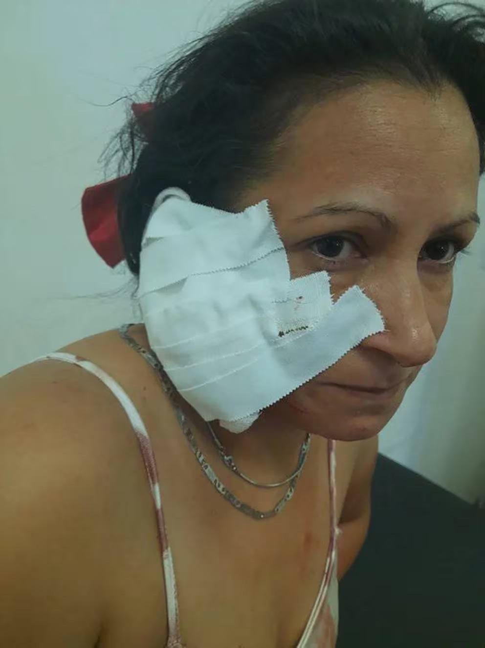 Le “cortaron” la oreja con los dientes