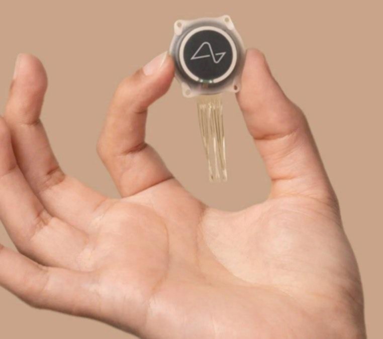 Un chip en la cabeza: ¿La prueba que lo cambia todo?