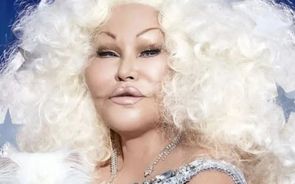 Murió Jocelyn Wildenstein, la “mujer felina”: su última noche y el antes y después de las cirugías
