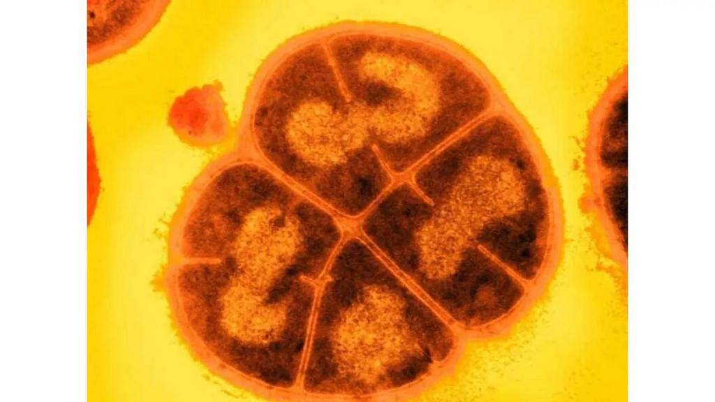 Conan, la “superbacteria” que soporta la radiación extrema