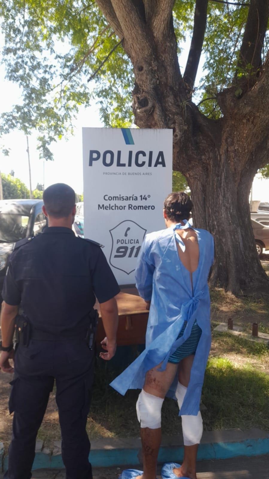 Resistió un robo y un disparo le rozó un ojo