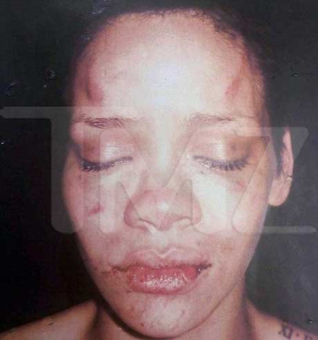Difunden imagen de cantante tras ser golpeada por su novio