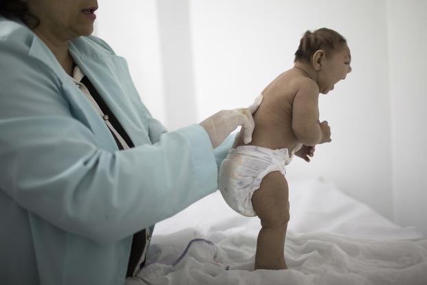 Nuevas evidencias relacionan al zika con la microcefalia en bebés