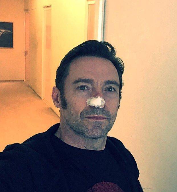 Hugh Jackman se operó de un tumor por quinta vez