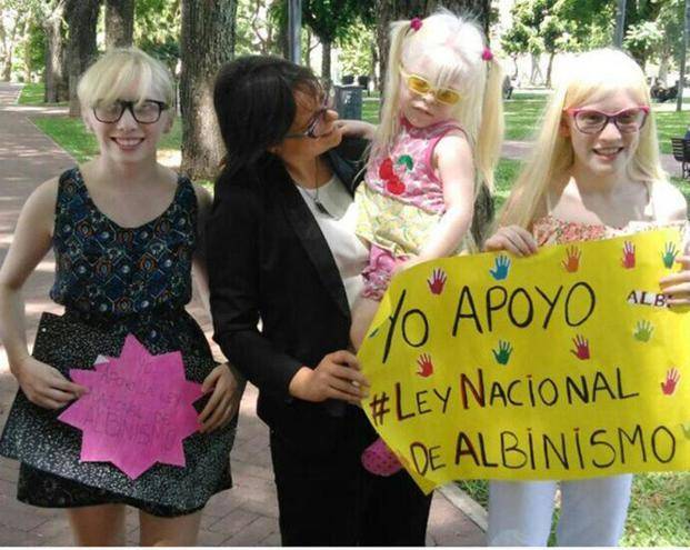 Albinos: impulsan un proyecto de ley pionero