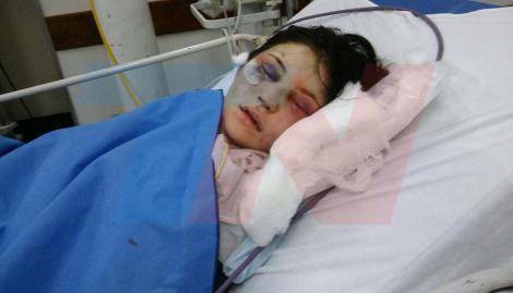 Desgarrador relato de la chica golpeada por anestesista
