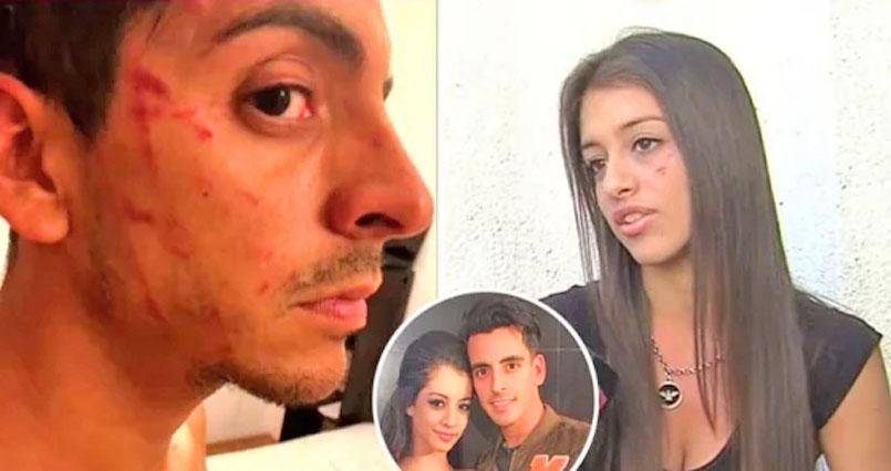 El contraataque del hermano de Pampita: mostró su rostro golpeado