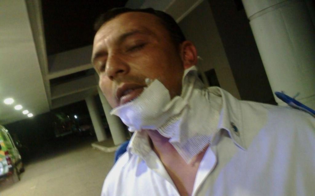 Pidió ayuda para zafar de un control y entre varios atacaron a la Policía