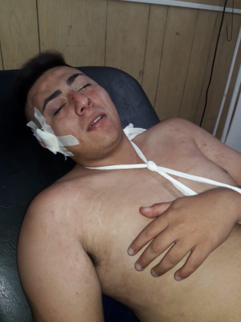 Fue a divertirse con el hermano y terminó en el hospital, con lesiones