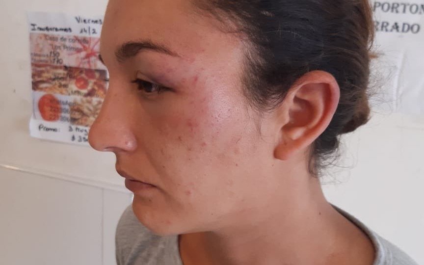 Una joven denunció brutal golpiza en la vía pública
