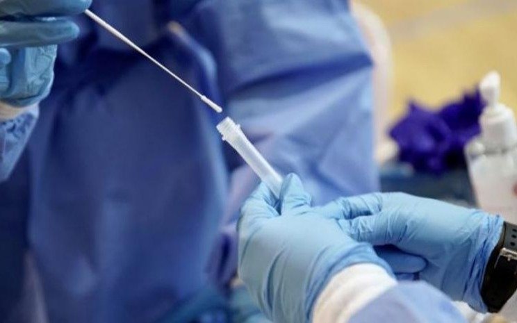 El test anal para detectar coronavirus llegó al país: por ahora descartan su aplicación masiva