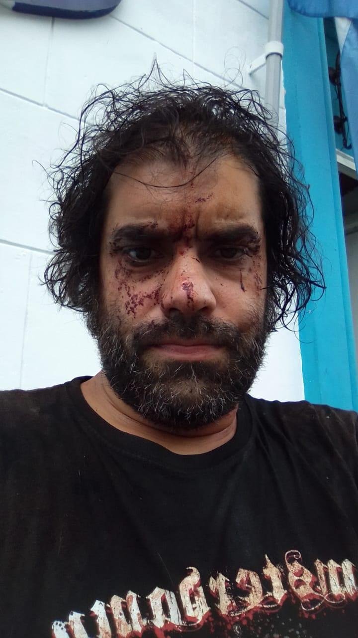 Atacaron a golpes a un docente en su casa de Ringuelet