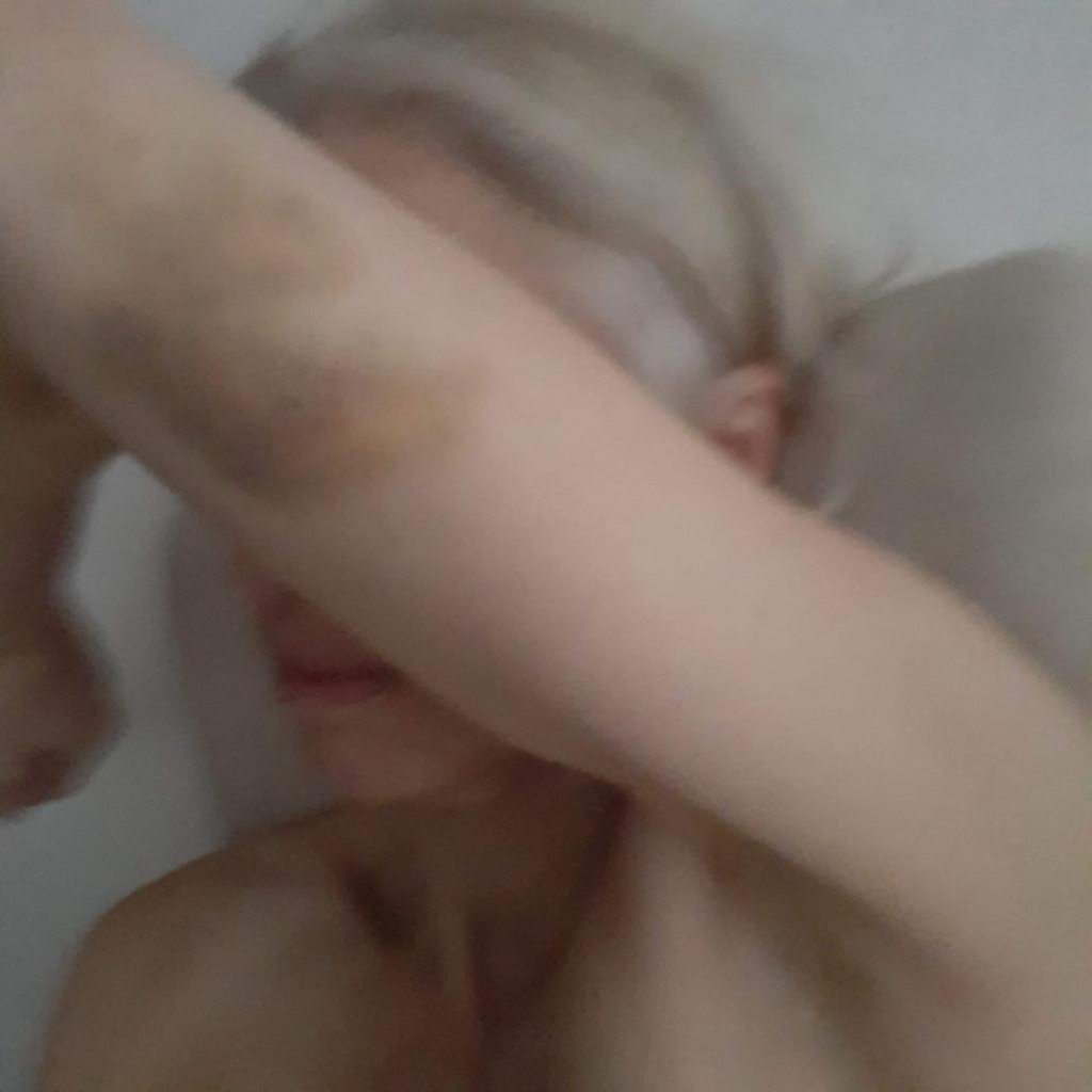 Desgarrador pedido de víctima de violencia de género a la Justicia: “Yo quiero vivir”