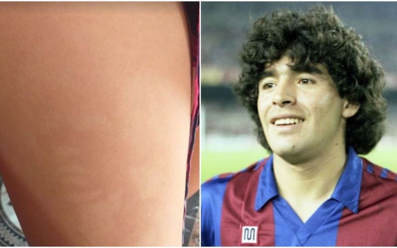 "Fua, el Diego": vio la silueta de Maradona en la pierna de su novia tras exponerse al sol en la Costa