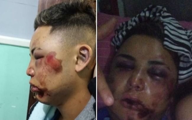 Buscan agresores de joven brutalmente golpeado