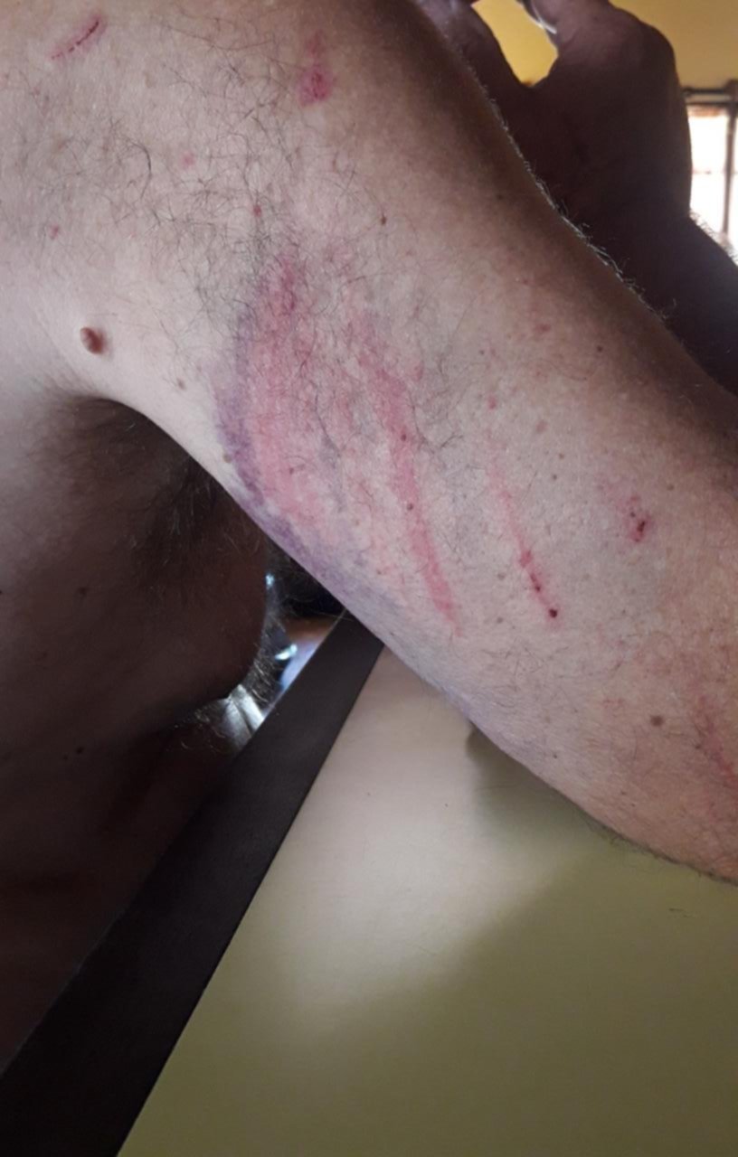 Violento ataque a una pareja de jubilados en una casa de Berisso
