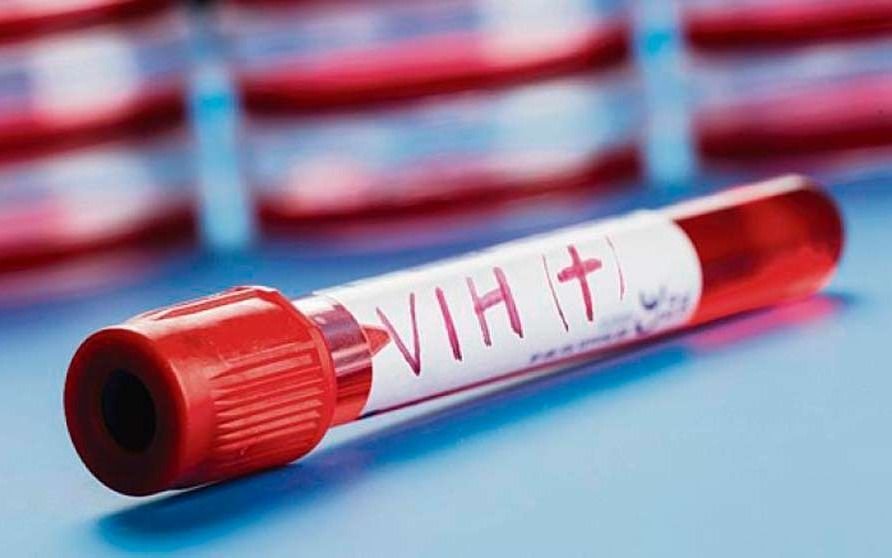 Científicos descubren una nueva variante del VIH más peligrosa y contagiosa
