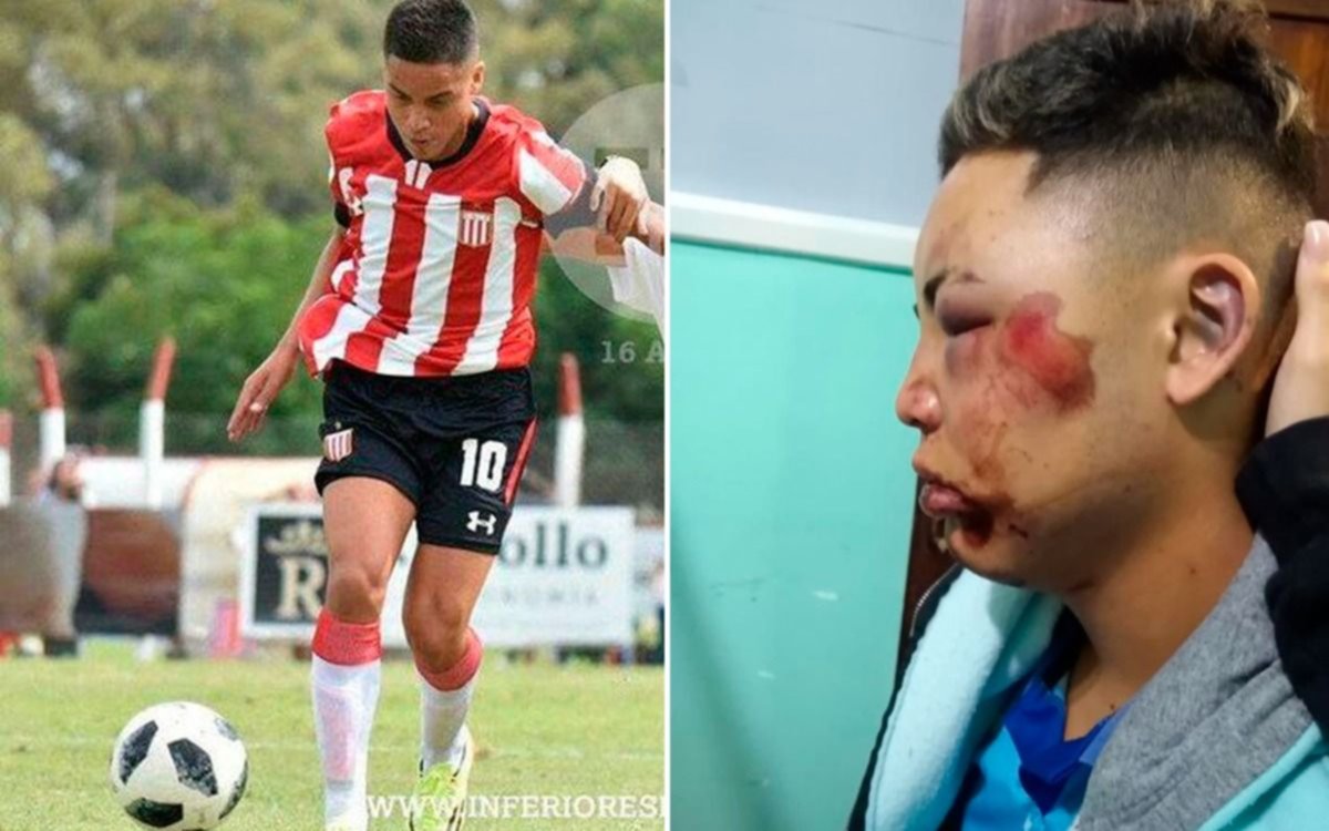 Feroz golpiza a un ex jugador de Estudiantes a la salida de un boliche