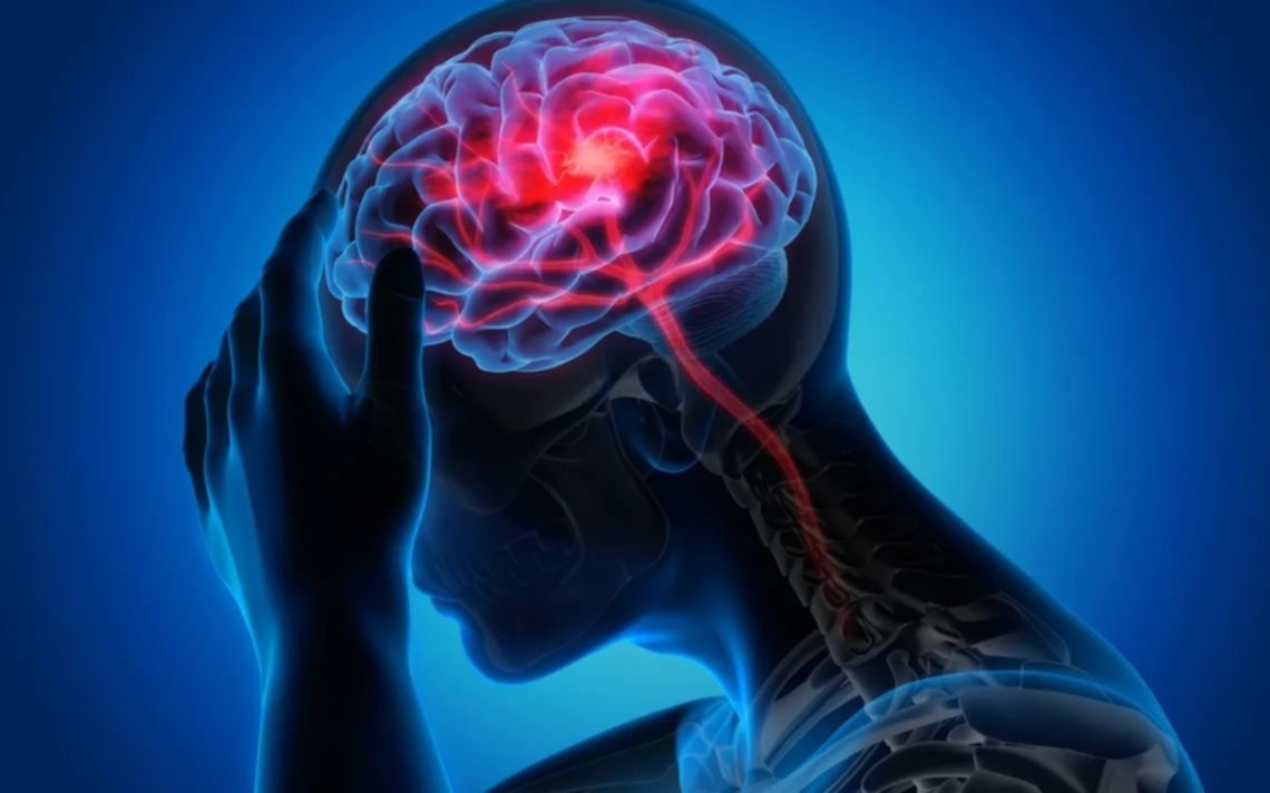 El cerebro podría sufrir cambios similares a los del Alzheimer tras un contagio de covid grave