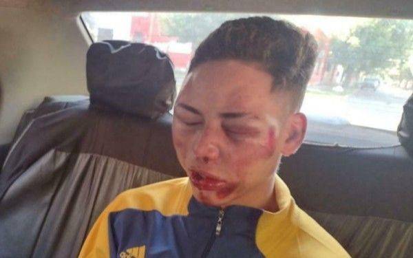 Reclaman justicia por una salvaje agresión