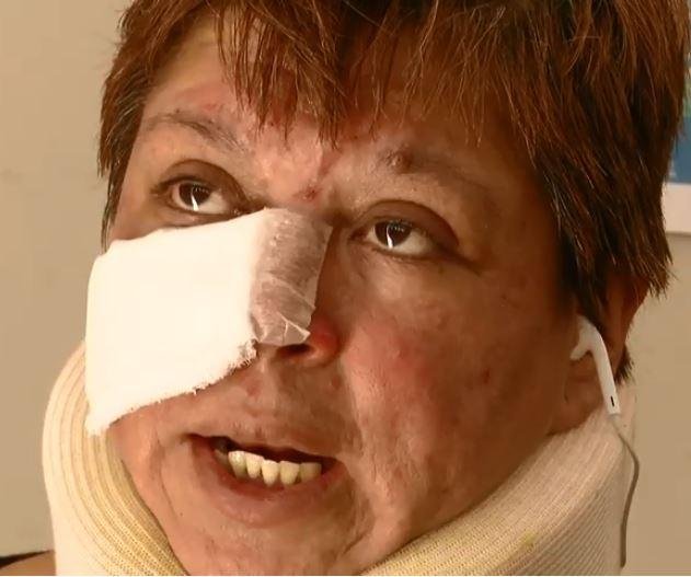 La falta de apoyo policial, otra vez en la mira por el caso de la agente golpeada