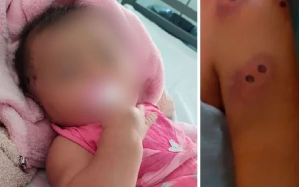 Madre y beba de 5 meses heridas con balas de goma en un operativo policial en Merlo