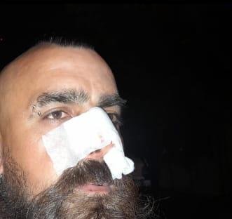Otra agresión impune: fracturan de un codazo a un inspector vial
