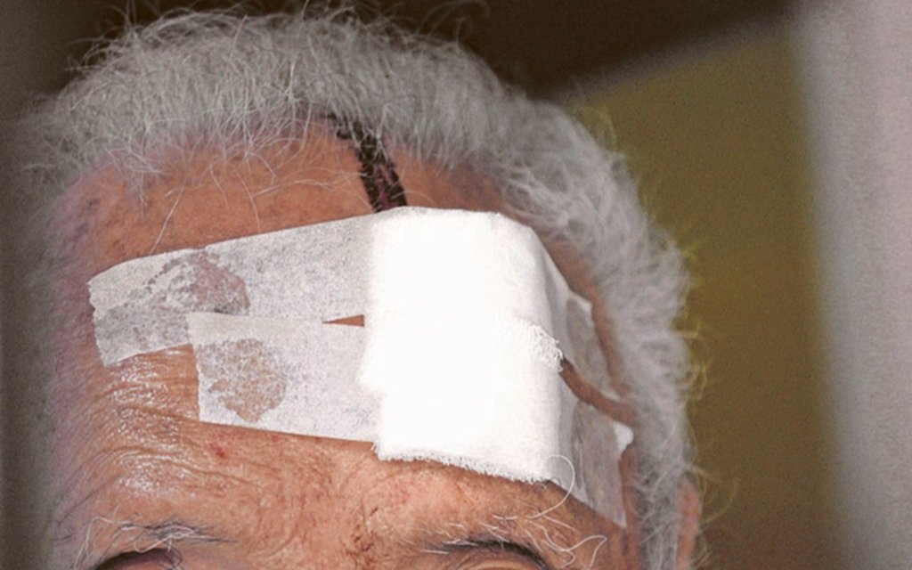 Con 80 años, se enfrentó a dos ladrones para defender a su esposa