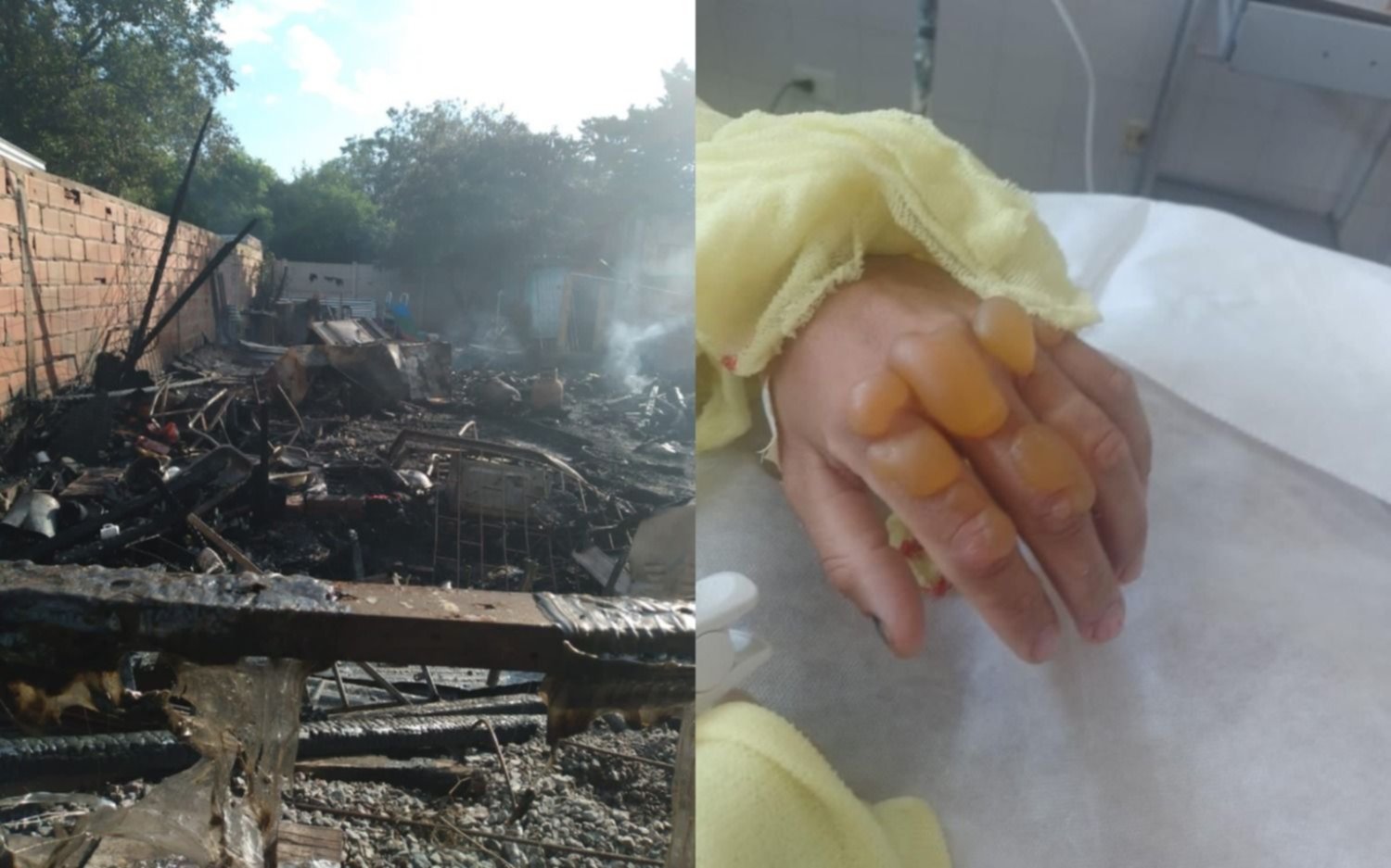 Arriesgó su vida para salvar a sus hijos y perdieron todo en un incendio: necesitan ayuda