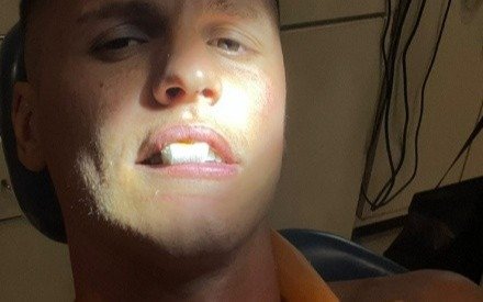 Carrillo es duda por la pérdida de tres dientes para la visita ante el Tatengue