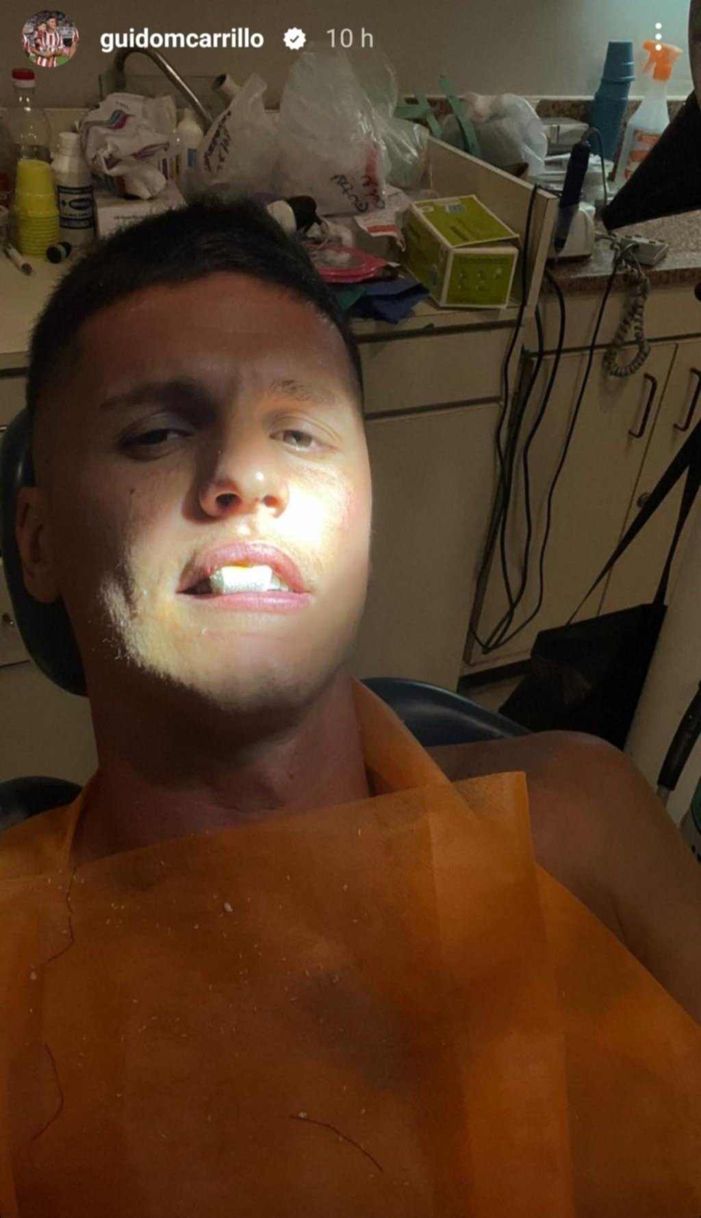Carrillo pasó de la cancha al dentista y se sumó a la lista de dudas pensando en Unión